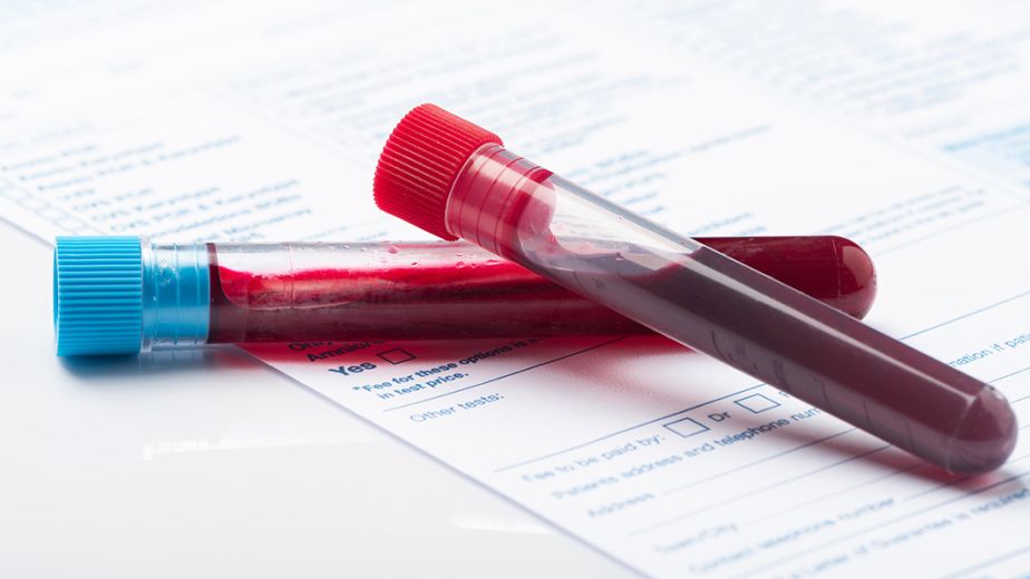 muestras-de-sangre-en-el-examen-medico-migratorio